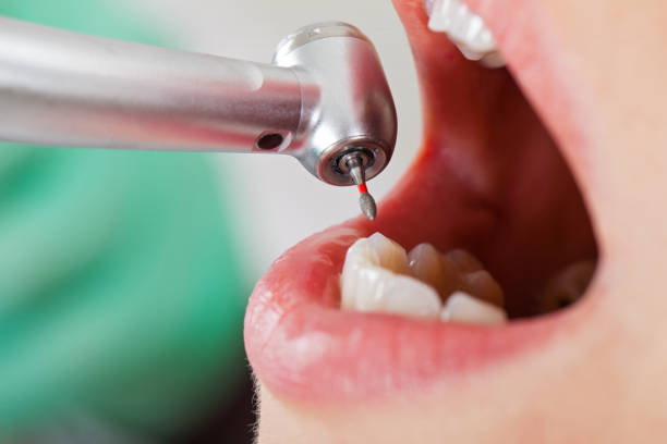 Best Pediatric Emergency Dentist in West Allis, WI